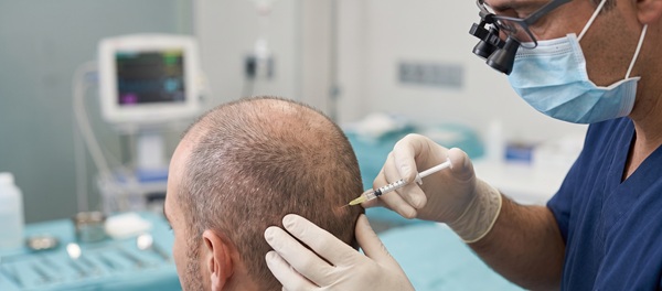 Local Anesthesia Administration Hair Transplant Spain Local anesthesia scalp injection during a FUE hair transplant procedure in Spain