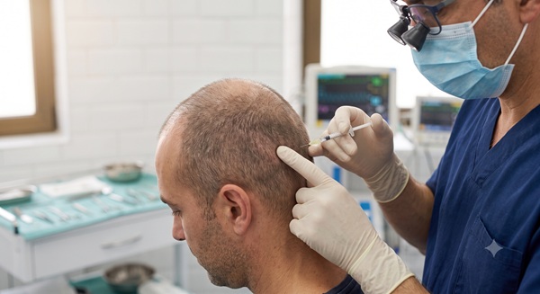 Medically precise illustration of a hair transplant local anesthesia injection on a male patient’s scalp in a regulated Spanish clinic, emphasizing safety and dosage protocols.