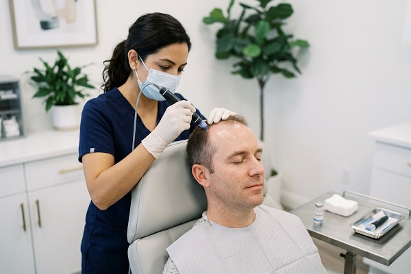 A specialist in exosome therapy in Spain to rejuvenate the scalp of a patient with alopecia